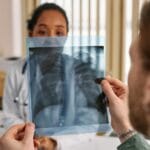 Ból w klatce piersiowej: jakie badania kardiologiczne wykonuje się w pierwszej kolejności Lekarz omawia z pacjentem rentgen klatki piersiowej w gabinecie