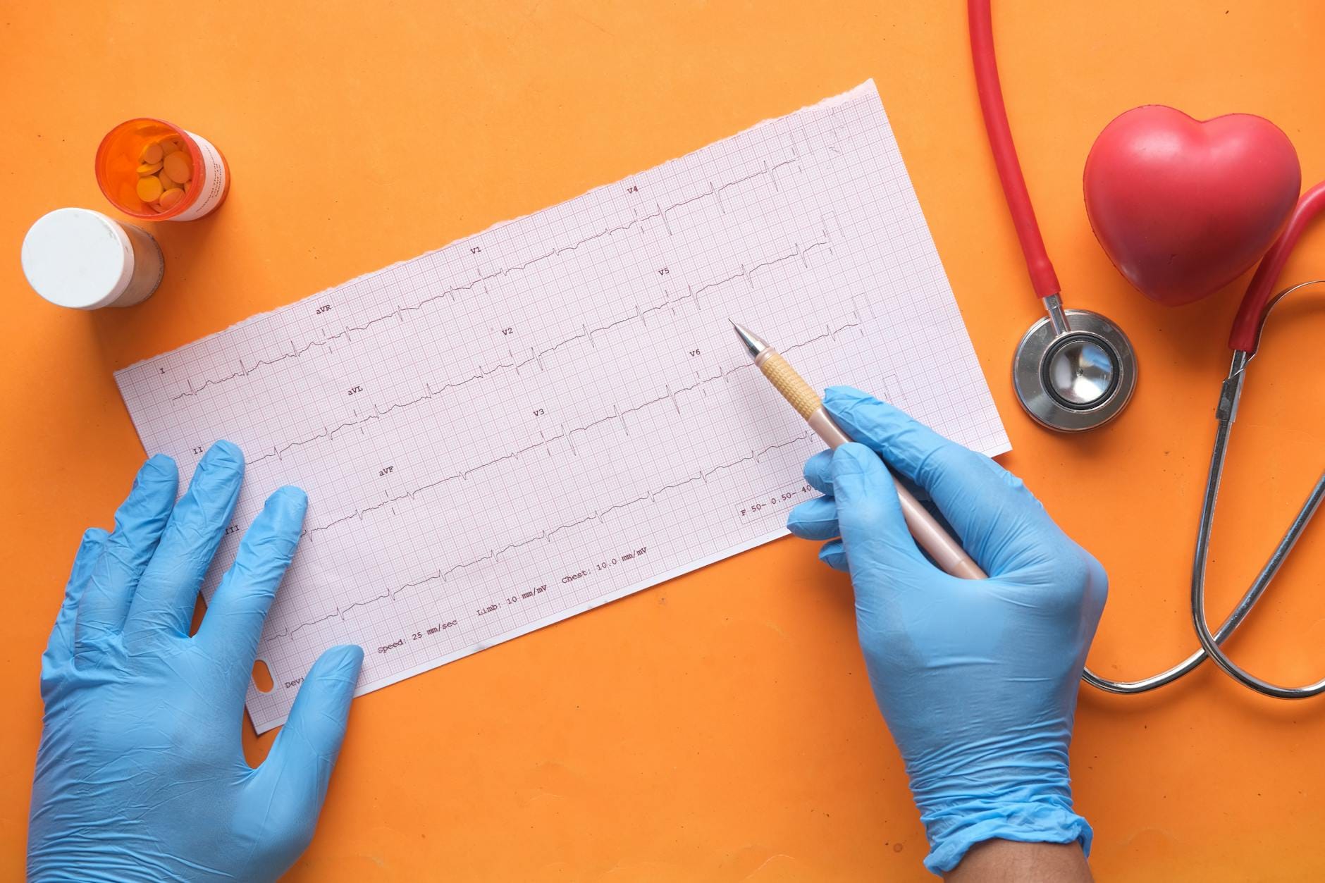 Ręce w rękawiczkach analizują EKG obok stetoskopu i tabletek