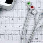 Przewody EKG na wydruku kardiogramu ilustrują badanie pracy serca