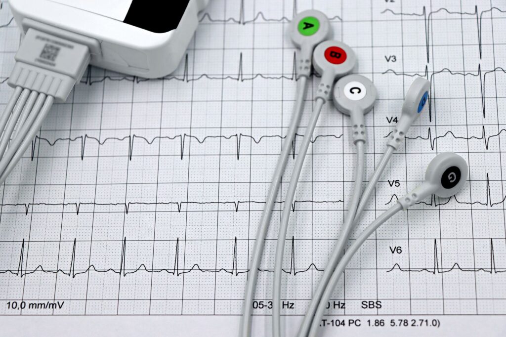 Przewody monitora EKG na wydrukowanym zapisie kardiogramu